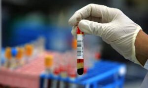 antidroga (1) - WeWeed.it test antidroga medico